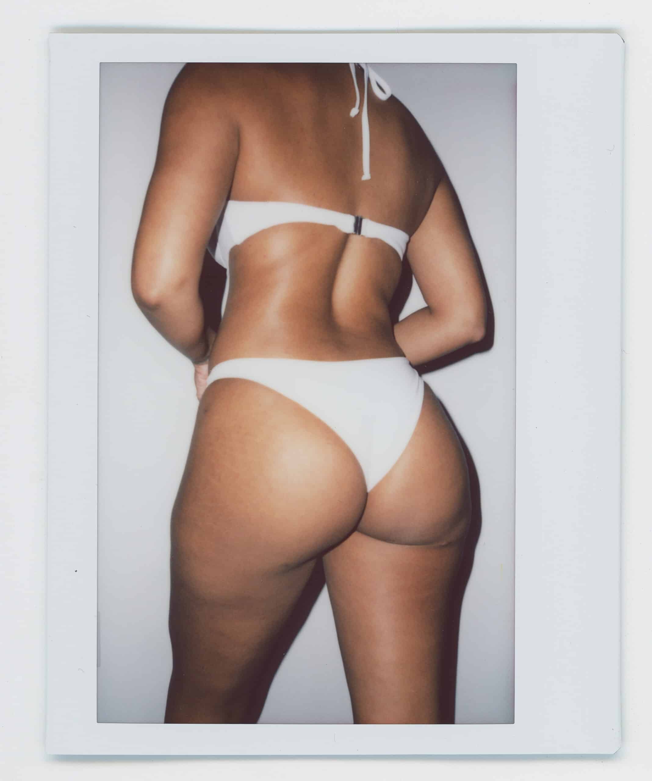 Awake Brazilian Butt Lift (BBL) Miami and California | Squlpt