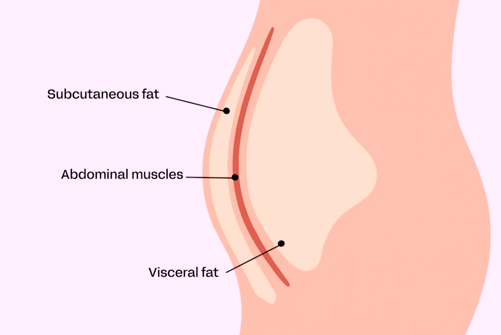 Grasa abdominal